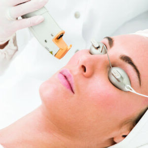 Laser para manchas de la edad 3 Sesiones