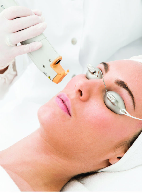 Laser para manchas de la edad 3 Sesiones