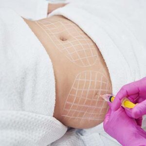 Quemadores de grasa 5 Inyecciones