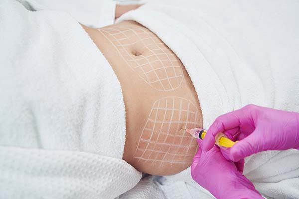 Quemadores de grasa 5 Inyecciones