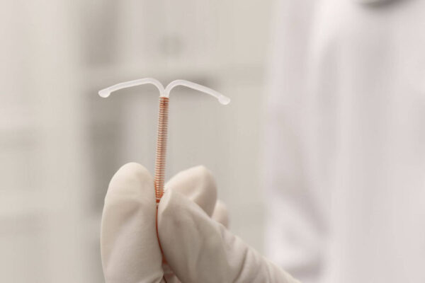 DIU Removal/ Retiro de Dispositivo intrauterino