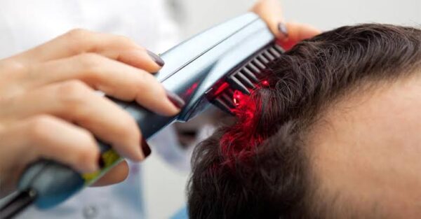 Laser para el cabello 5 sesiones